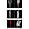 小动物Micro-CT，牙齿结构形态研究